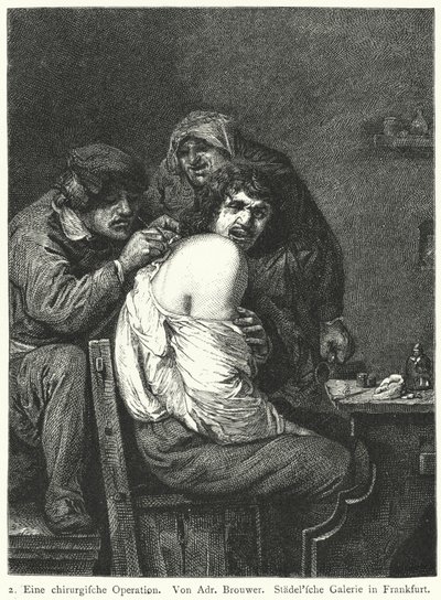 Takaisin operaatio tekijältä Adriaen (after) Brouwer