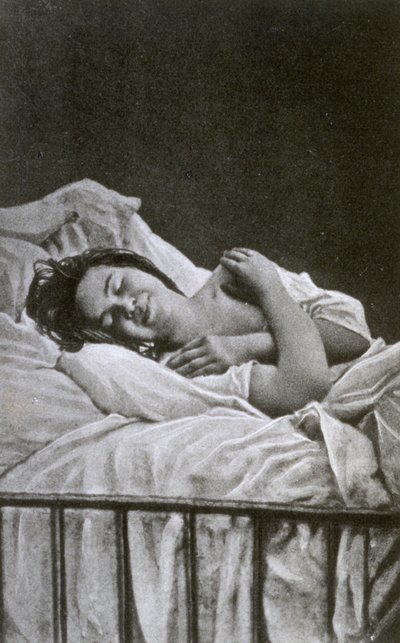 Nuori nainen, jolla on hysteriakohtaus, 1878 tekijältä Albert Londe
