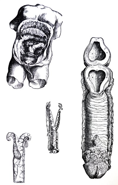 Levyt De Humani Corporis Fabrican viidennestä kirjasta tekijältä Andreas Vesalius