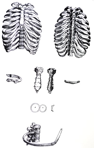 Lautaset De Humani Corporis Fabrican ensimmäisestä kirjasta tekijältä Andreas Vesalius