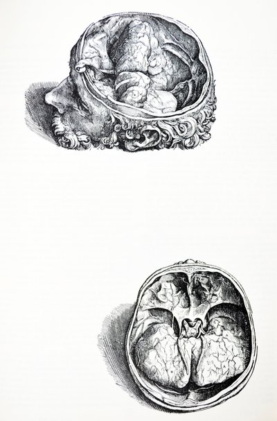 Lautaset De Humani Corporis Fabrican seitsemännestä kirjasta tekijältä Andreas Vesalius