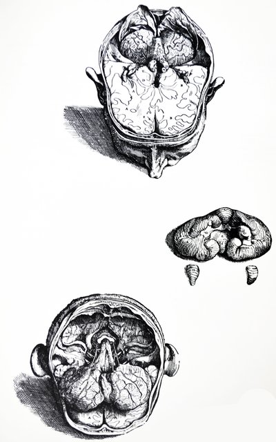 Lautaset De Humani Corporis Fabrican seitsemännestä kirjasta tekijältä Andreas Vesalius