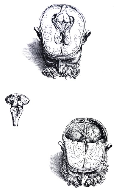 Lautaset De Humani Corporis Fabrican seitsemännestä kirjasta tekijältä Andreas Vesalius