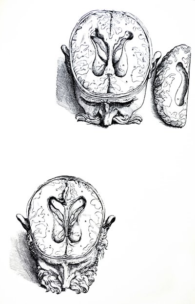 Lautaset De Humani Corporis Fabrican seitsemännestä kirjasta tekijältä Andreas Vesalius