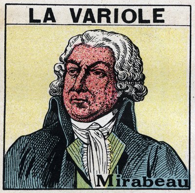 Honore Gabriel (Honore-Gabriel) Riquetin, Mirabeaun kreivin (1749-1791) muotokuva, jossa kasvot isorokkoa sairastavat. Isorokon aiheuttamien arpien välttämiseksi potilaita tulee hoitaa huoneissa tai mennä vain punaiseen valoon, jossa ei ole ultraviolettisä tekijältä Anonymous Anonymous