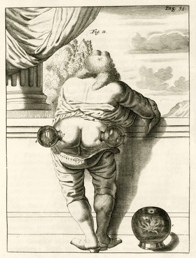 Esimerkki kuppauksesta, Frederik Dekkerin teoksesta The Practice of Medicine, 1694 tekijältä Dutch School