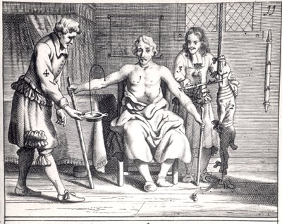 Verensiirto koirasta, Johannes Schultesin (1595-1645) Armamentarii Chirurgici, julkaistu Amsterdamissa, 1671 tekijältä Dutch School