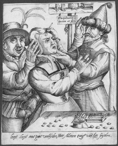 Trepaning, kaiverrus H. Weydmans (1500-luku) tekijältä Dutch School