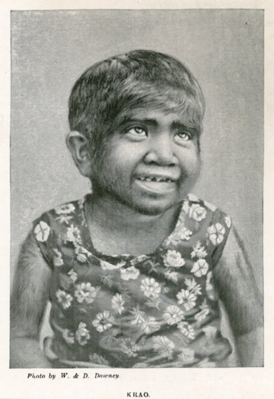Krao, The Missing Link, esillä Aquariumissa, Westminster, Lontoo, vuonna 1887 tekijältä English Photographer