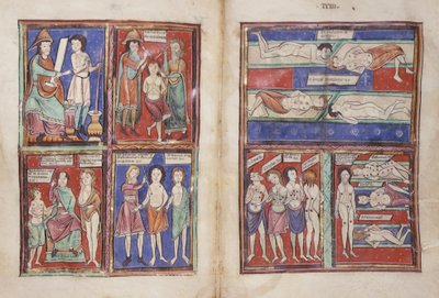 Sloane 1975 fol.91v-92 Lääketieteelliset kohtaukset tekijältä English School