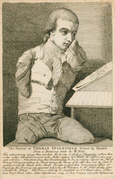 Thomas Inglefield, syntynyt 18. joulukuuta 1769 Hookissa, Hampshiressa, ilman käsiä tai jalkoja tekijältä English School