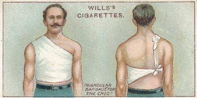 Kolmikulmainen side rintakehään, nro. 37 Willss Cigarettes -korttien First Aid -sarjasta, 1913 tekijältä English School