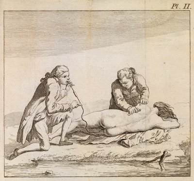 Fumigaattorin käyttö tupakan savun puhaltamiseksi hukkuneen naisen suolistoon elvytyksen helpottamiseksi, noin 1790 (kaiverrus). tekijältä English School