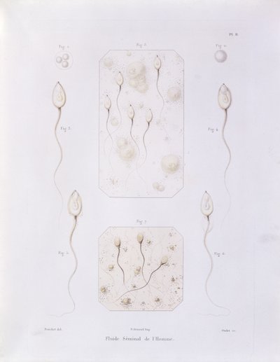 Siemenneste, Theorie Positive de lOvulation Spontanee et de la Fecondation des Mammiferes et de lEspece Humaine, Felix-Archimede Pouchet (1800-72), kaivertanut Oudet, Pariisi, 1847 (värillinen eng) tekijältä Felix Archimede Pouchet