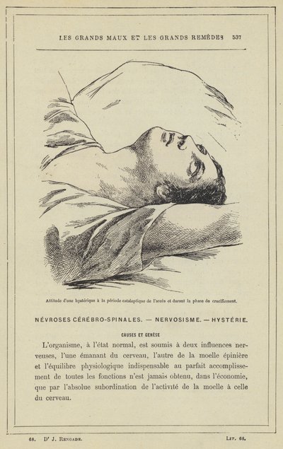 Hysteerisen asenne pääsyn kataleptisen jakson aikana ja ristiinnaulitsemisen aikana (väri litho) tekijältä French School