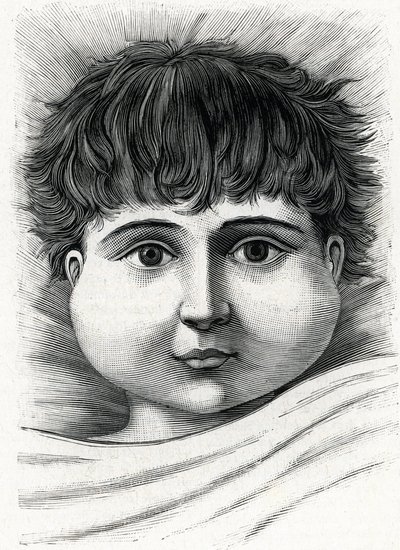 Lapsi, jolla on sikotauti (kaiverrus) 1888 tekijältä French School