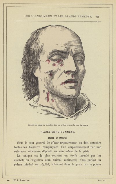 Kärpästen toukkien kuoriutuminen onteloissa ja kasvojen ihon alla (väri litho) tekijältä French School