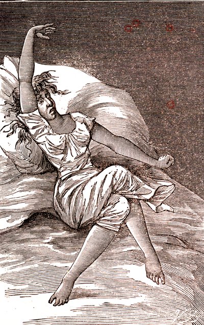 Päänsärkyä, melankoliaa ja hysteriaa, ahdistusta. 1887 (kaiverrus) tekijältä French School