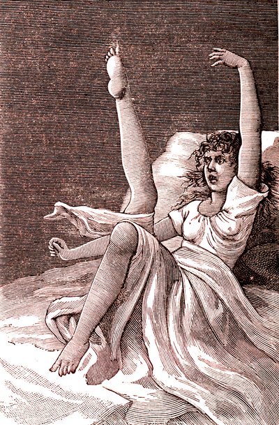 Hysteria, äärimmäisen henkinen ilmiö, psykoosit ja psykoneuroosi.1887 (kaiverrus) tekijältä French School