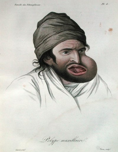 Leuan polyyppi, paroni Jean Louis Alibertin (1768-1837) kirjasta 1817 (värillinen kaiverrus) tekijältä French School