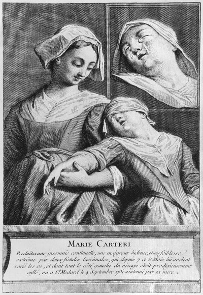 Sokean naisen Marie Carterin ihmeparantuminen diakoni Francois de Parisin haudalla Saint-Medardin seurakunnan hautausmaalla Pariisissa tekijältä French School