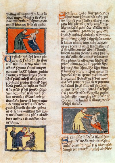 Ms H 89 fol.17r Surgery, Rogier de Salernen 
