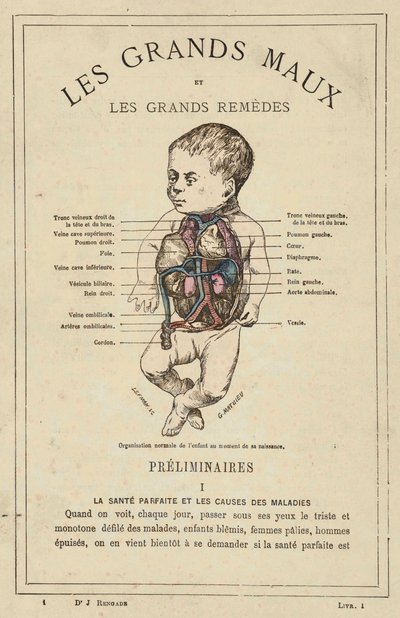 Lapsen normaali organisaatio syntymähetkellä (väri litho) tekijältä French School