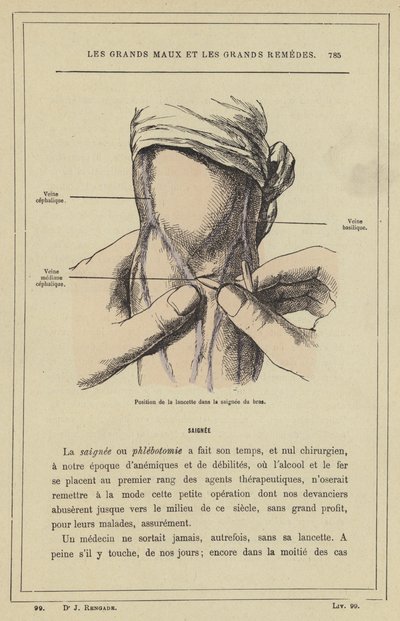 Lansetin asento käsivarressa (väri litho) tekijältä French School