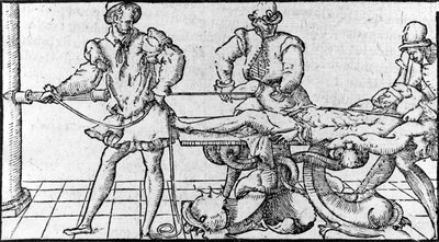 Dislokaatioiden vähentäminen, "Ambroise Parén lääketieteellinen sopimus", noin 1560. tekijältä French School