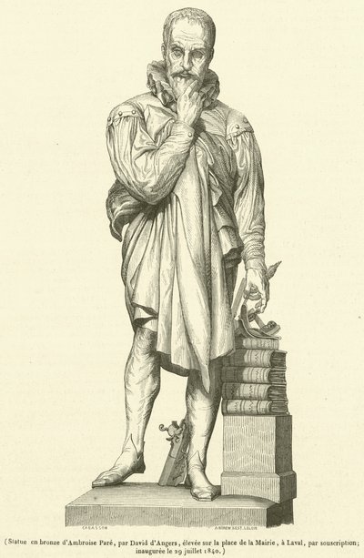Ambroise Paren pronssinen patsas (kaiverrus) tekijältä French School