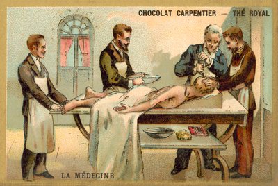Trepanning (chromolitho) tekijältä French School