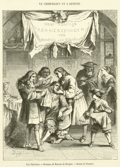 Operaatio (kaiverrus) tekijältä French School