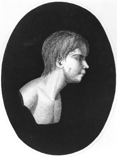 Victor of Aveyron, J.E.Itardin De lEducation dun homme sauvagen etukappale tekijältä French School