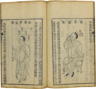 Shen Shi Yao Han Arvokas oftalmologian kirja, 1644 tekijältä Fu Renyu