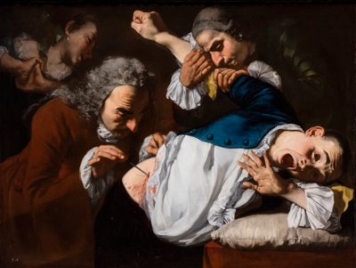 Operaatio, noin 1753/54 (Öljy kankaalle) tekijältä Gaspare Traversi