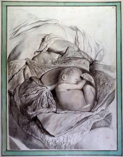 Ihmisen sikiön esitys kohdussa Gerard de Lairessen (1640-1711) kaiverrus, joka havainnollistaa Govert Bidloon (tai Govardin) (1649-1713) "Anatomia Humani Corporista" Pariisin lääketieteellisen tiedekunnan 1700-luvun kirjastossa tekijältä Gerard de Lairesse