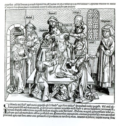 Ympärileikkaus, Hartmann Schedelin (1440-1514) teoksesta "Liber Chronicarum" tekijältä German School