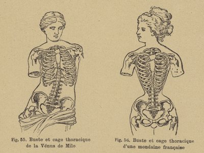 Venus de Milon rinnan ja rintakehän muodon vertailu 1800-luvun lopulla eläneen ranskalaisen sosialistin kanssa tekijältä German School