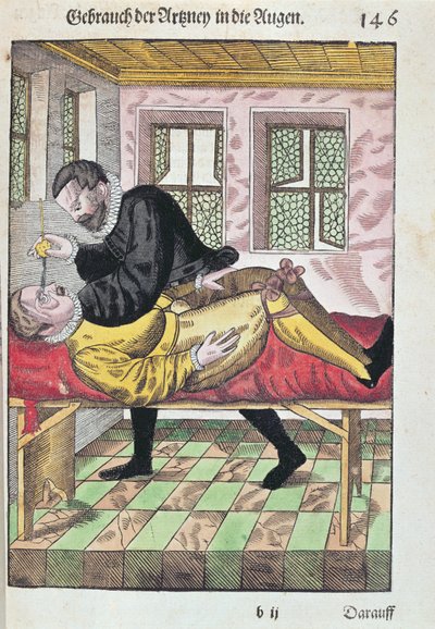 Eye Operation, Georg Bartischin (1535-1636) Ophthalmodouleiasta, julkaistu Dresdenissä vuonna 1583 (värillinen puupainatus) tekijältä German School