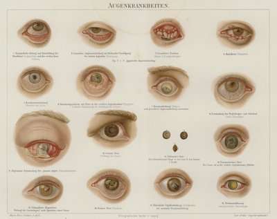 Silmäsairaudet (väri litho) tekijältä German School