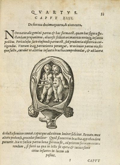 Ei-identtiset kaksoset kohdussa, kuvitus Rueffin 1587:n kirjan 4. luvusta Ihmisen sikiämisestä ja kasvusta. tekijältä German School