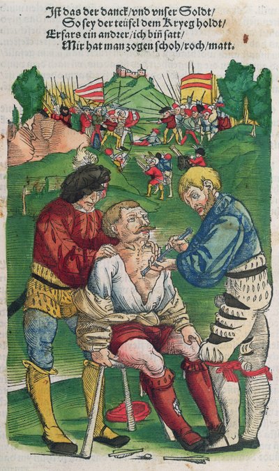 Nuolen poistaminen, Hans von Gersdorffin kuvitus Feldtbuch der Wundartzneysta, 1540 tekijältä German School