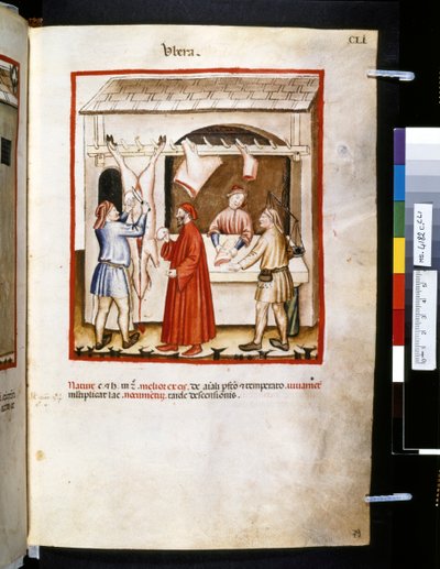 Ububchasym de Baldachin Theatrum sanitatis: "Ubera", 1300-luvun ensimmäinen vuosikymmen (pienoiskuva). tekijältä Giovannino de
