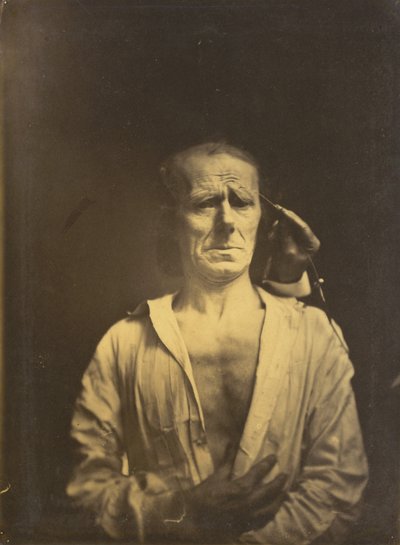 Spasmi m. corrugator supercilii erittäin voimakkaassa valossa (vasemmalla); Rento kasvot (kuvattu täydessä auringonpaisteessa) (oikealla) tekijältä Guillaume Benjamin Amant Duchenne