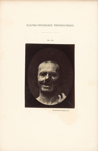 Valokuvasähköfysiologia, kuva 53. tekijältä Guillaume Benjamin Duchenne