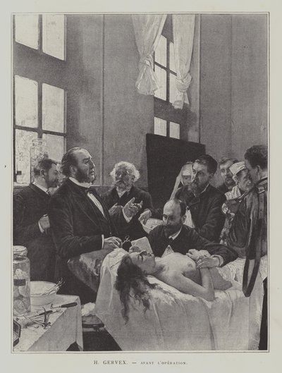 Avant lOperation (ennen käyttöä) tekijältä Henri Gervex