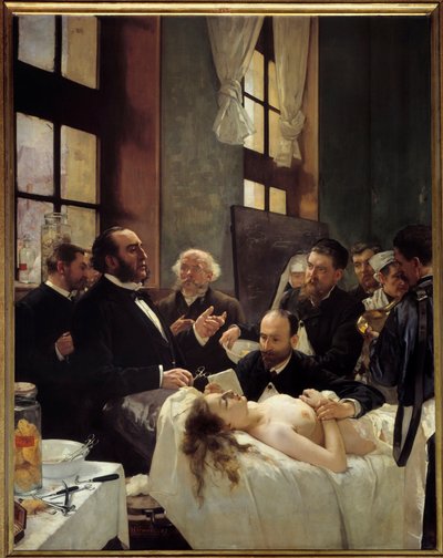 Tohtori Jules Emile (Jules-Emile) Pean (1830-1898) opetti Saint Louisin sairaalassa löytöään laivojen puristamisesta eli "" Ennen leikkausta"" Henri Gervexin (1852-1929) maalaus 1887 su. 2,42 x 1,88 m Pariisi, musee d