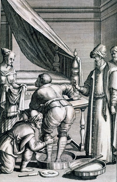 Verenvuoto jaloissa, Prospero Alpinin Medicina Aegyptiorum, julkaistu 1745 tekijältä Italian School