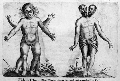 Erityyppiset ihmishirviöt Kaiverrus "Hirviöiden luonne, niiden syyt ja erot", italialaistutkija Fortunio Whilei (1577-1656). 1646 tekijältä Italian School