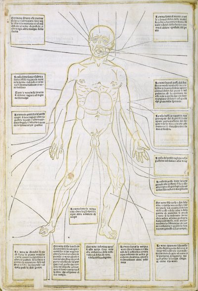 Kuvitus "Fassiculus Medicinae" Venetsiasta tekijältä Italian School